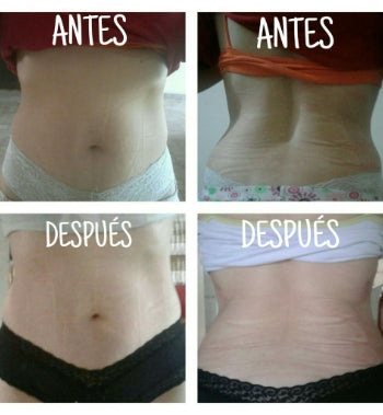 FAJA DE YESO - LIPOYESOTERAPIA